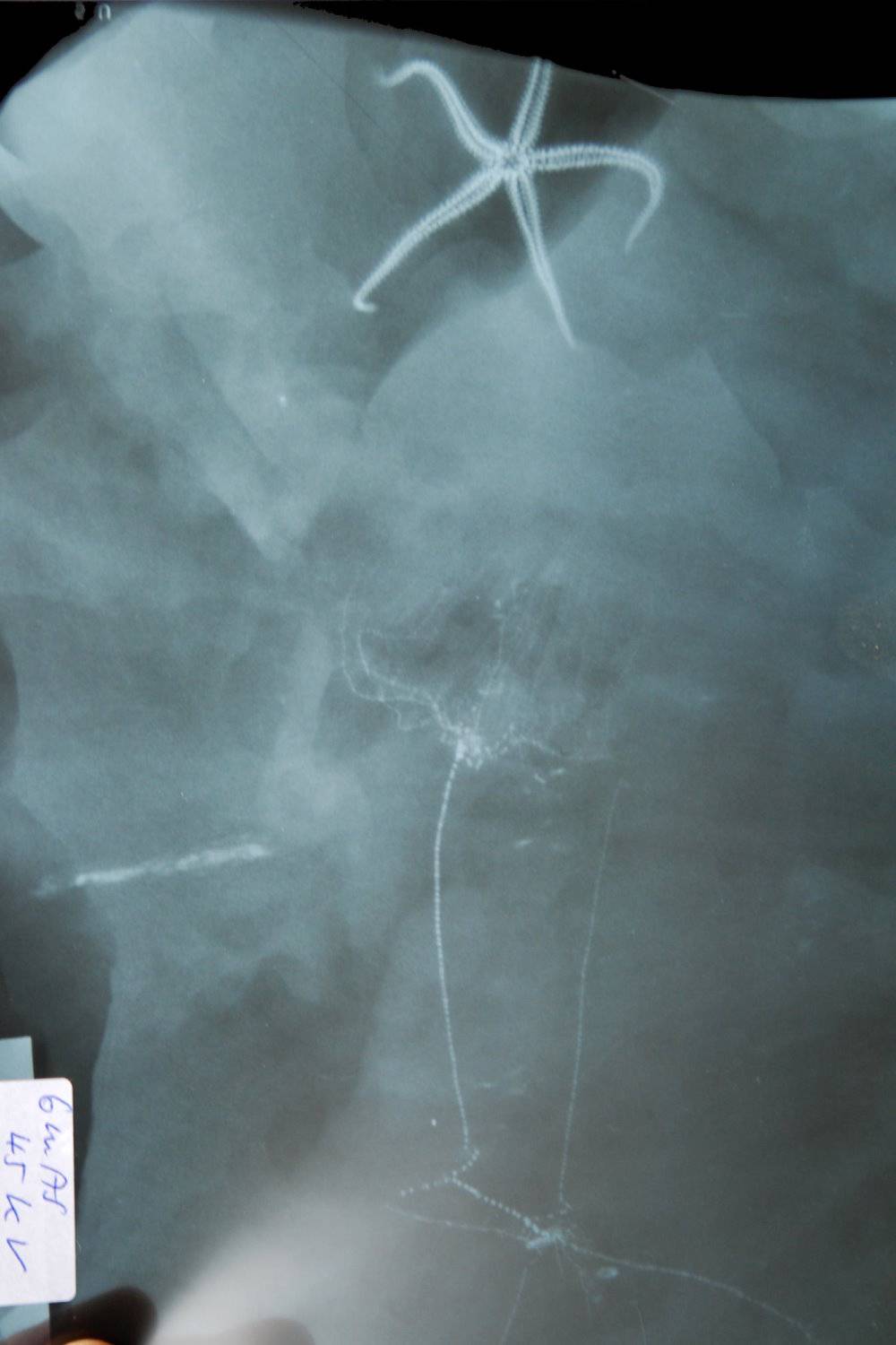 Rhadinocrinus dactylus, Bundenbach