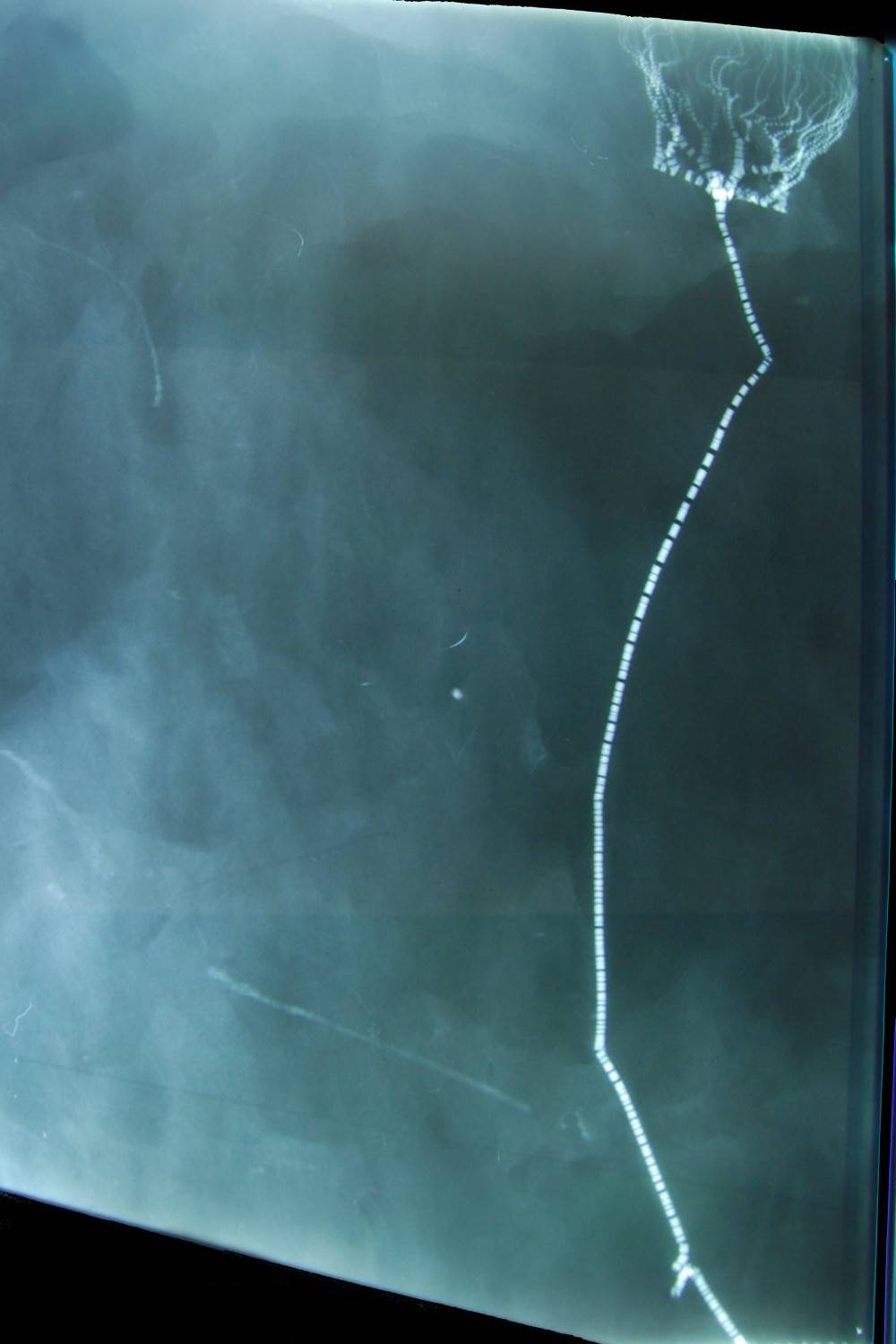 Taxocrinus stuertzi; Bundenbach