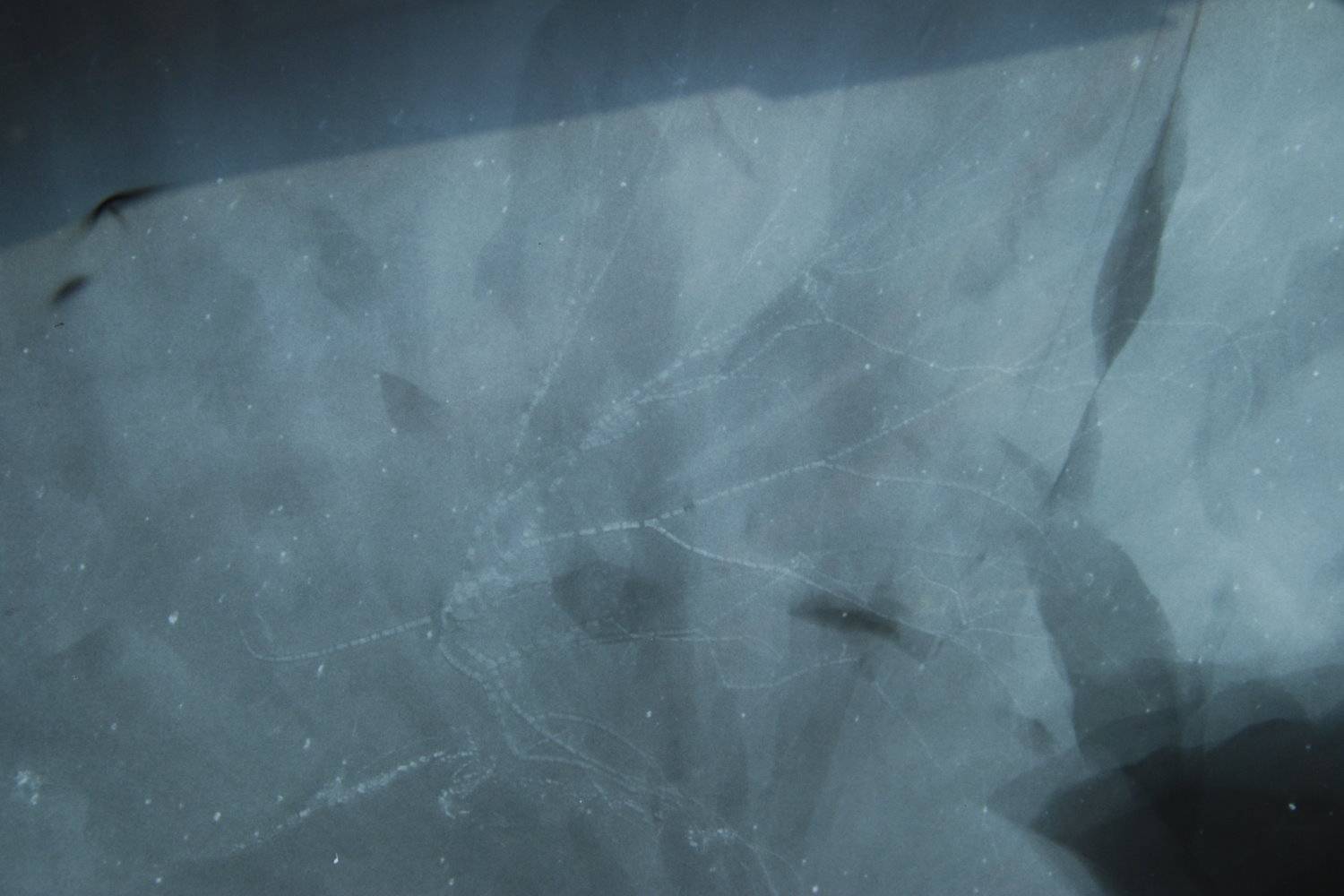 Follicrinus grebei, Bundenbach