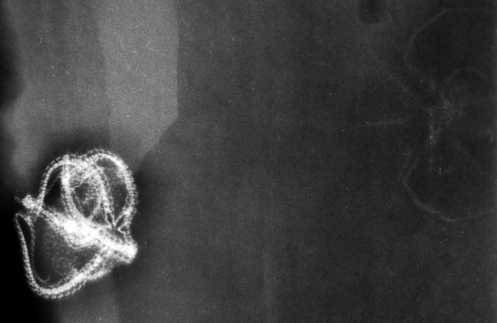 Mimetaster, Taeniaster x-ray Mimetaster_Taeniaster_xray